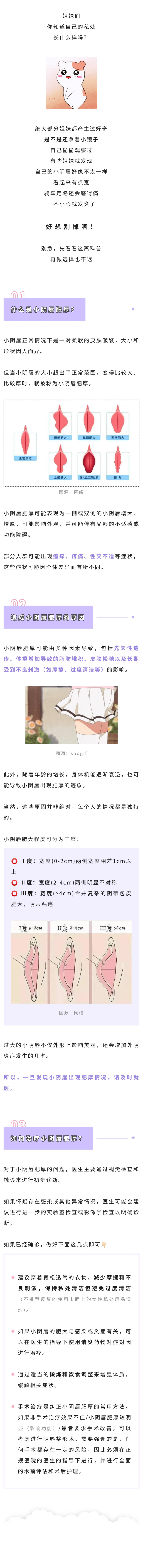 妇科  小阴唇肥厚别急着“割掉”，先看这篇&rarr;.jpg