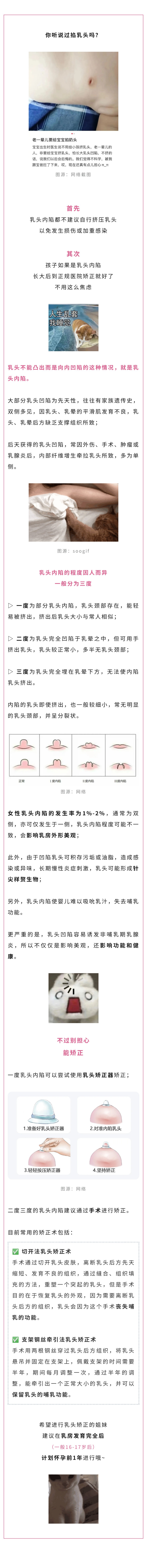 乳腺  不是每个人的咪咪都是向外凸的.jpg