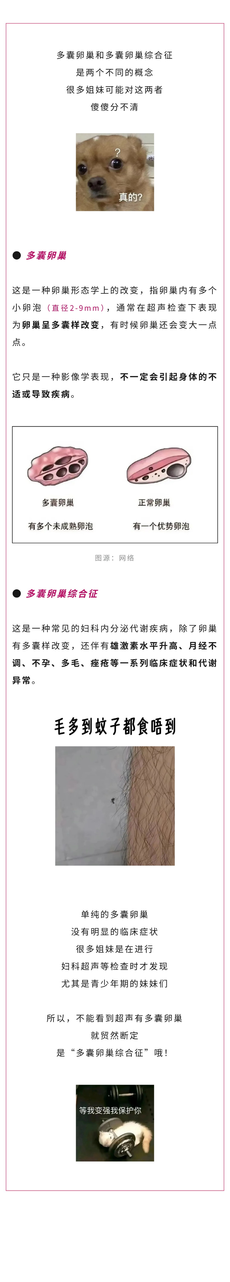 妇科  “多囊卵巢”和“多囊卵巢综合征”到底有什么区别？.jpg