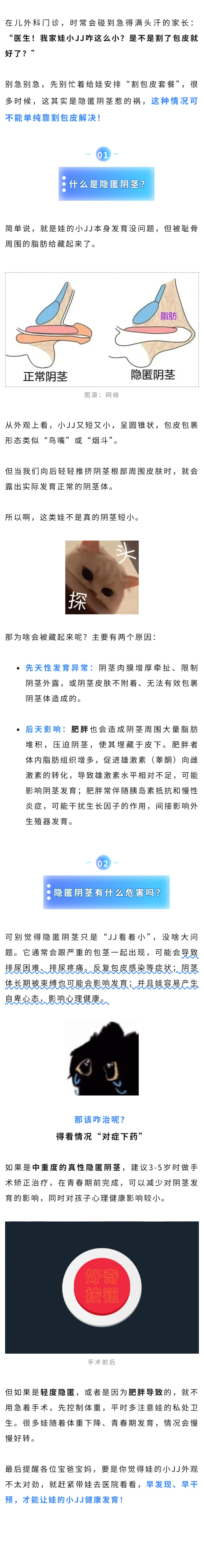 儿科  家有男宝请注意：这种包皮不能割.jpg