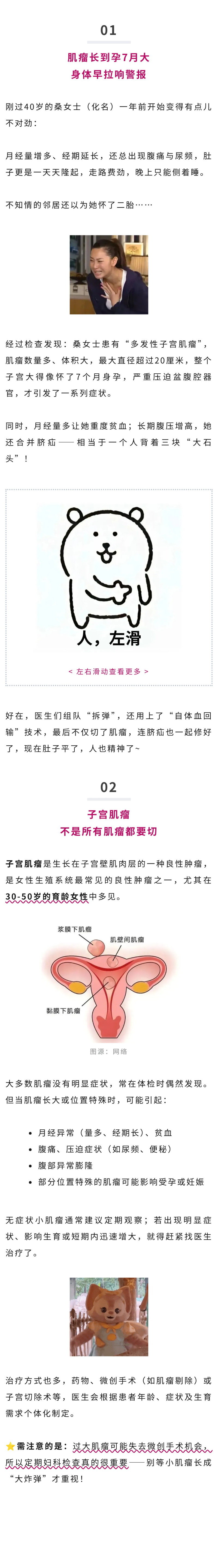 妇科  肚子鼓成孕7月，邻居以为怀二胎？竟是多发性子宫肌瘤在搞事.jpg