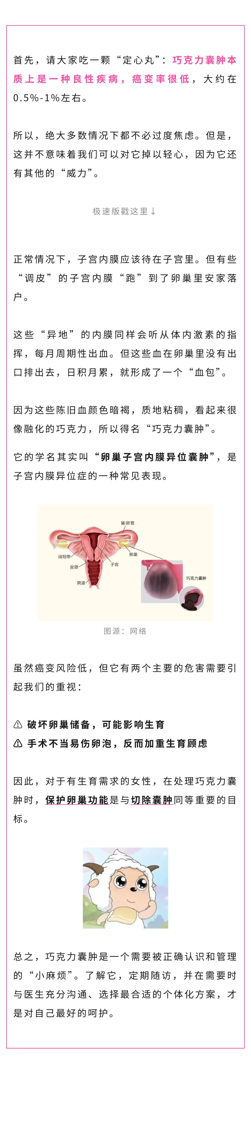 妇科  巧克力囊肿会癌变吗？.jpg
