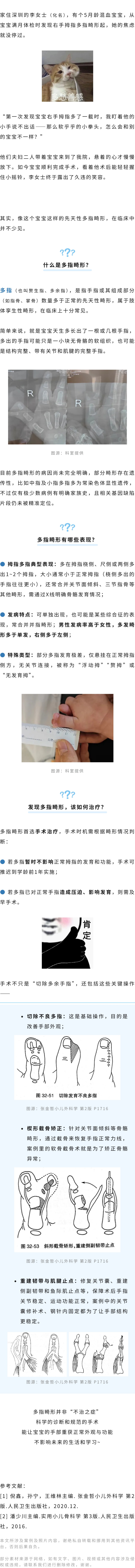 儿科  宝宝拇指多长了一截，怎么办？.jpg