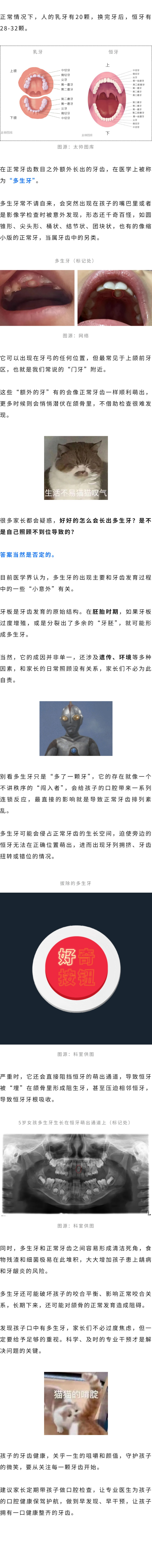 保健  孩子嘴里多长牙？别慌，这是多生牙.jpg