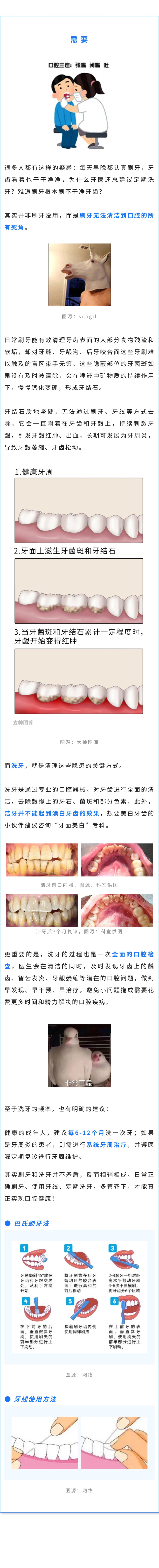 保健  每天认真刷牙，还需要定期洗牙吗？.jpg