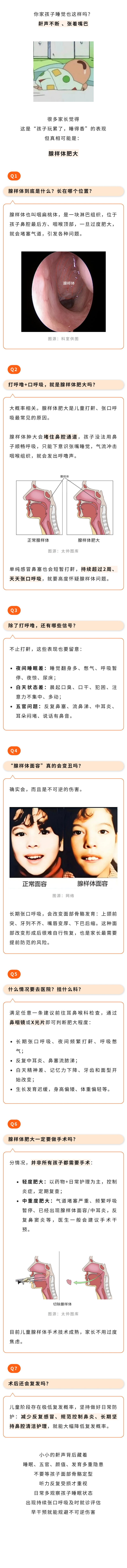 保健  长期张嘴睡觉不可逆，一文看懂腺样体面容怎么来的.jpg