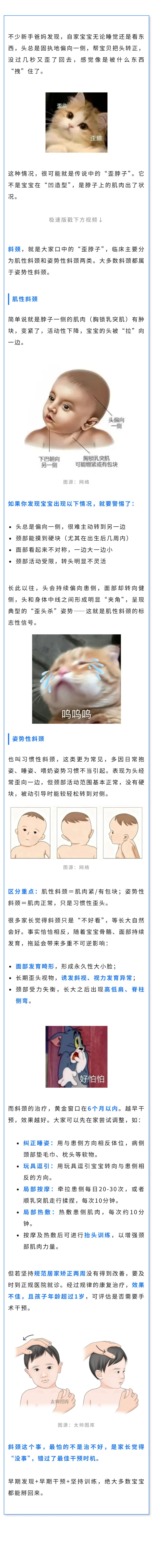 保健  宝宝“歪头杀”，当心是斜颈！.jpg
